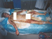 1������8��������III�Ȅ�(chu��ng)������M����(j��ng)���á�ˎ���Y(ji��)�ϡ��ķ���̎�����Ѳ��ֱ�������˞�Qˎǰ��(chu��ng)����r��