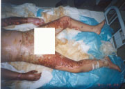 5������8�����p������ǰ�|��III�Ȅ�(chu��ng)������M����(j��ng)���á�ˎ���Y(ji��)�ϡ��ķ���̎�����Ѳ��ֱ�������˞�Qˎǰ������r��