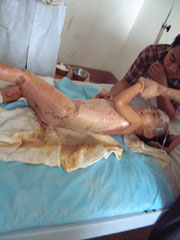 ��(chu��ng)��Һ�����ڵı��F(xi��n)��