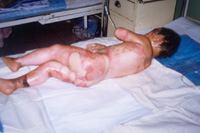 ��������4 �q������,95%ȫ������e��������45%������40%���\���10%�����3������Ժ��2�졣