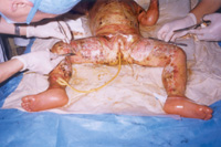 ��������4 �q������,95%ȫ������e��������45%������40%���\���10%�����6������Ժ��5����