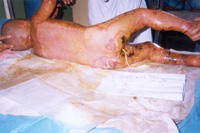 ��������4 �q������,95%ȫ������e��������45%������40%���\���10%�����12������Ժ��11����